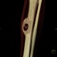 Metastasis of melanoma in the tibia: CT - Computed tomography